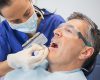 Replacing Multiple Teeth With Implants