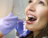 Dentures vs. Dental Implants – Which Are Best?